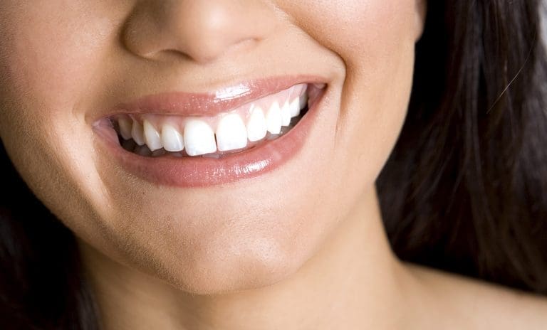 benefits of porcelain veneers