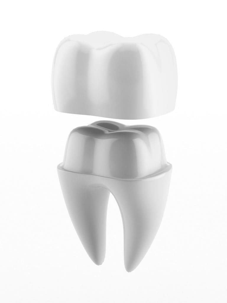 benefits of dental crowns