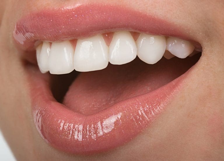 benefits of teeth whitening